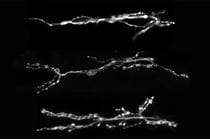 Images of three different synapses. Photos by Mitchell D'Rozario.