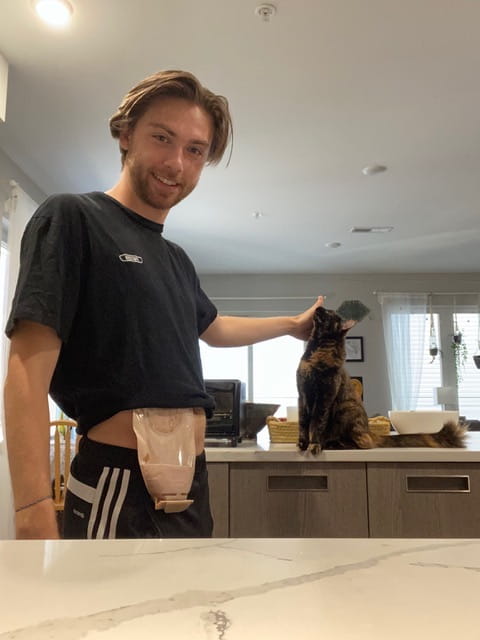 Evan Charlesworth wearing an ostomy bag and posing with his pet cat