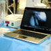 laptop scan
