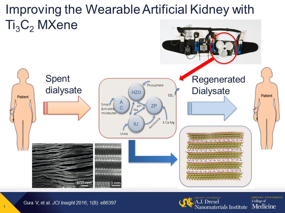 Wearable artificial kidney technology from MXene