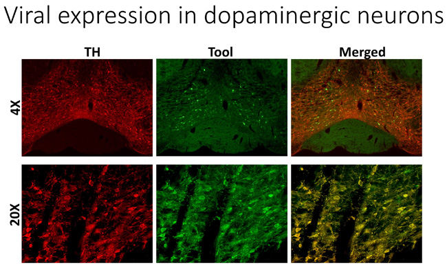 Viral expression in dopaminergic neurons image from the Mortensen Lab at Drexel University College of Medicine.