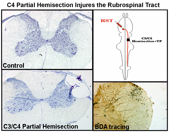 Drexel Fischer Lab: C4 Partial Hemisection Injuries the Rubrospinal Tract
