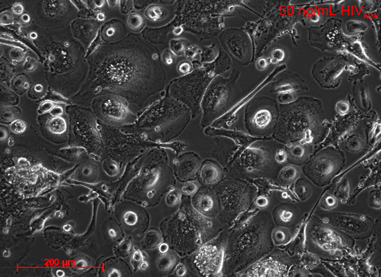Gaskill Lab: Brightfield image of primary human macrophages infected with 50 ng/mL HIVADA 7 days post infection.