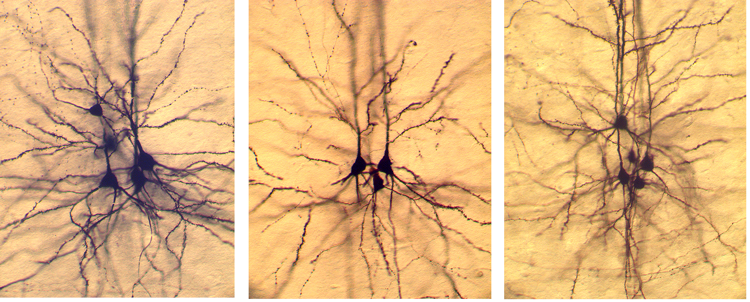 Biocytin-labeled layer 5 pyramidal neurons.