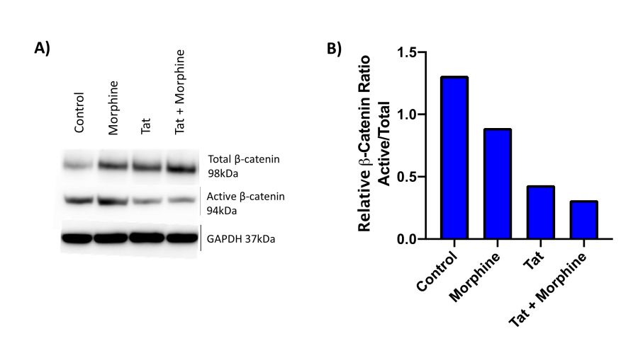 Klase Lab research: Tat protein and morphine show combined affect in suppressing β-catenin