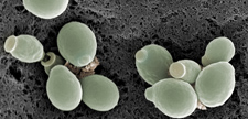Yeast cells, Candida albicans, SEM