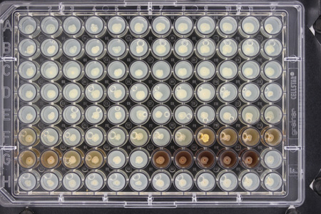 Colony morphologies of 96 Burkholderia cenocepacia isolates from cystic fibrosis patients (University of British Columbia).