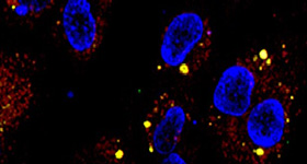 Drexel Ajit Lab Image: Exosome uptake by HUVEC cells.