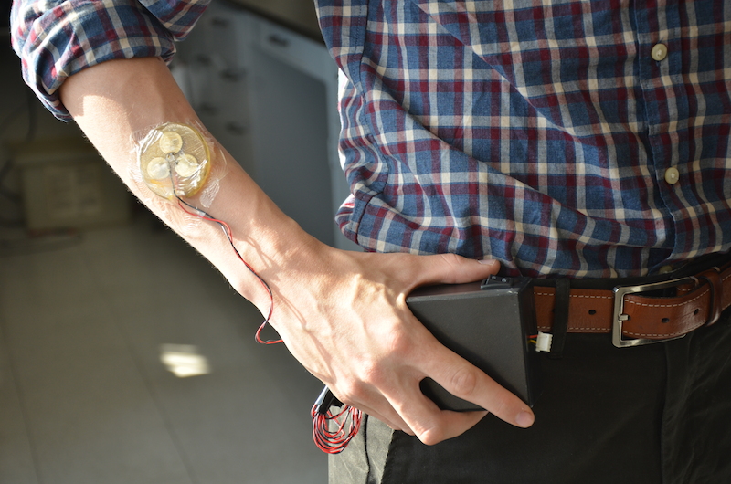 NIH Funds Clinical Trial to Test Device That Heals Wounds With