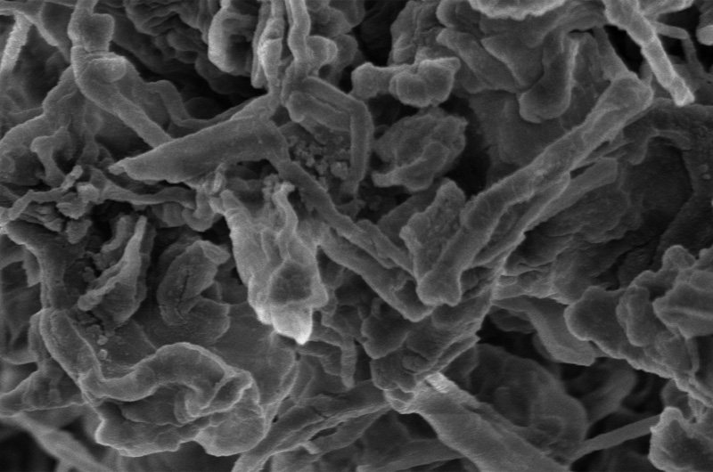Drexel researchers have reported that adding nanodiamonds to the electrolyte solution in lithium batteries can prevent the formation of dendrites, the tendril-like deposits of ions that can grow inside a battery over time and cause hazardous malfunctions. (Photo courtesy of Drexel University and Tsinghua University).