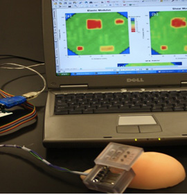 Piezoelectric finger sensor technology developed at Drexel is being integrated into the Intelligent Breast Exam (iBE) technology at UE LifeSciences.