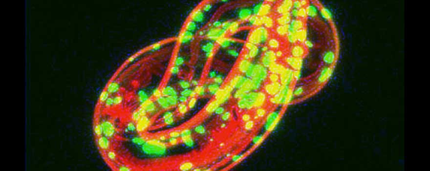 C. elegans model of aggregation-prone SOD1 mutant protein. Green - SOD1-YFG fusion protein, 127x mutant; red - muscle actin. Photography by Tali Gidalevitz