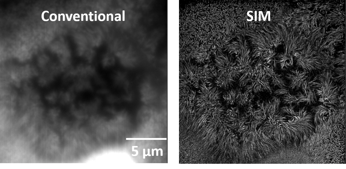 Microvilli WF vs SIM