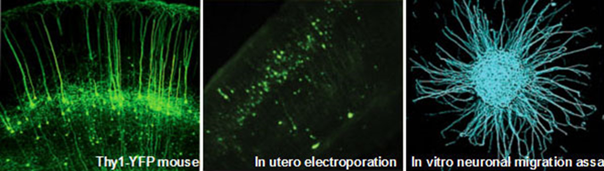 Toyooka: Thy 1 YFP mouse; In utero electroporation; In vitro neuronal migration assay