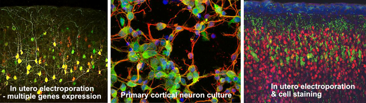 Toyooka: In utero electroporation multiple genes expression; Primary cortical neuron culture; In utero electroporation cell staining