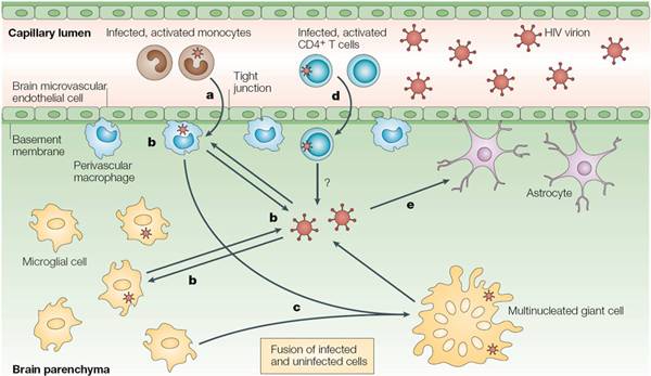 Schematic depiction of HIV neuroinvasion and syncytia formation