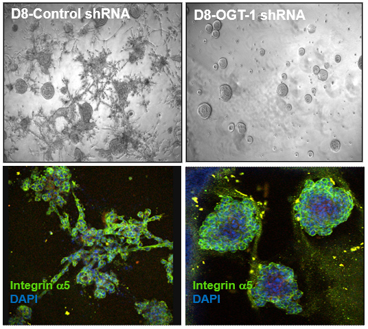 Targeting OGT levels in breast cancer cells blocks growth and invasion in 3D organoid culture.