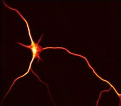 Baas laboratory research image, microtubule arrays of the neuron.