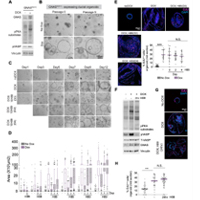 Oncogenic GNAS uses PKA-dependent and independent mechanisms to induce cell proliferation in human pancreatic ductal and acinar organoids.