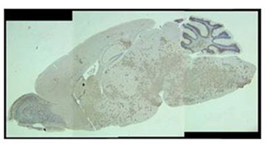 Immunohistochemistry  of brain section (C57BL/6J mice) at day 5 post-infection with a neurovirulent coronavirus
