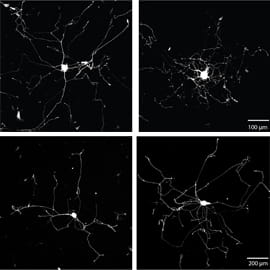 Neurons grew more branched or more elongated, depending on experimental conditions, in the research by Donnelly, Twiss and colleagues.