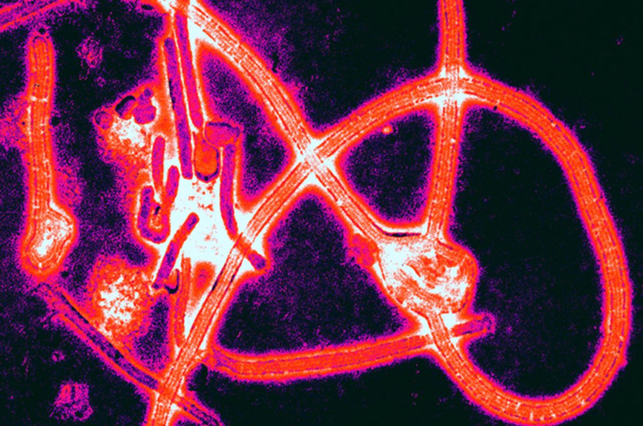 "Ebola virus particles" by Thomas W. Geisbert, Boston University School of Medicine - PLoS Pathogens, November 2008 direct link to the image description page doi:10.1371/journal.ppat.1000225. Licensed under Creative Commons Attribution 2.5 via Wikimedia Commons - http://commons.wikimedia.org/wiki/File:Ebola_virus_particles.jpg#mediaviewer/File:Ebola_virus_particles.jpg