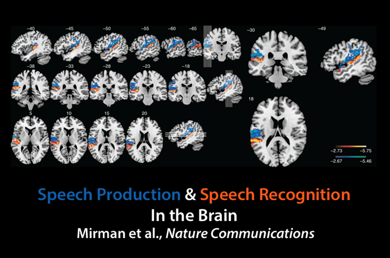 Voxel-lesion symptom map shows areas associated with speech production (blue-green) and speech recognition (red-yellow) factors in the brain. Credit: Mirman et al., Nature Communications