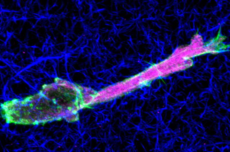 A microscopic image of a tumor cell migrating through collagen.