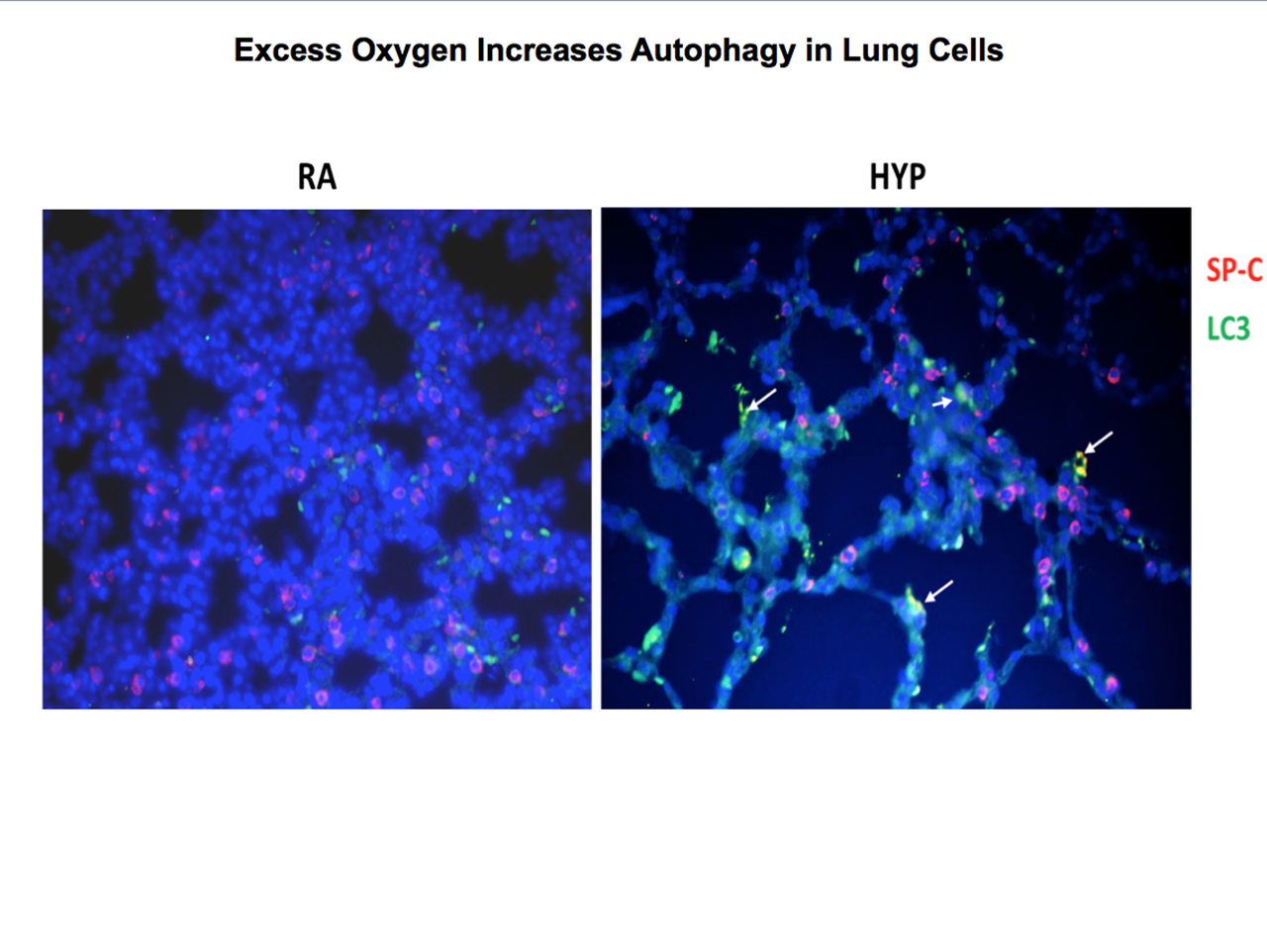 Lung Cells in Mice