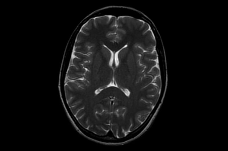 A scan of a human brain. Photo courtesy of Sean Novak.