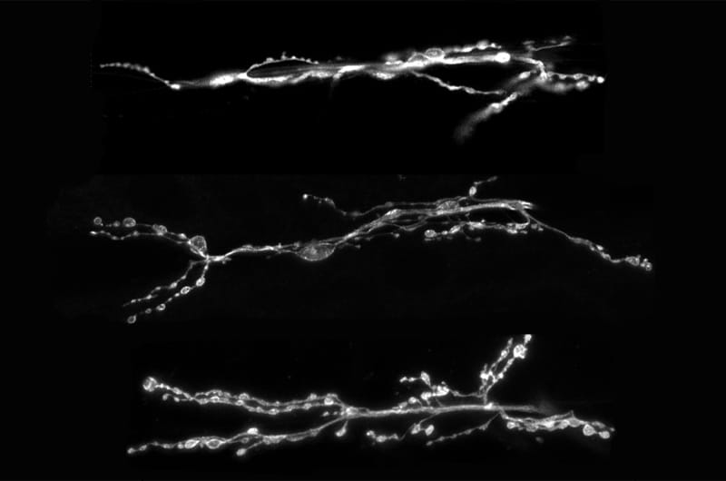 Images of three different synapses. Photos by Mitchell D'Rozario.