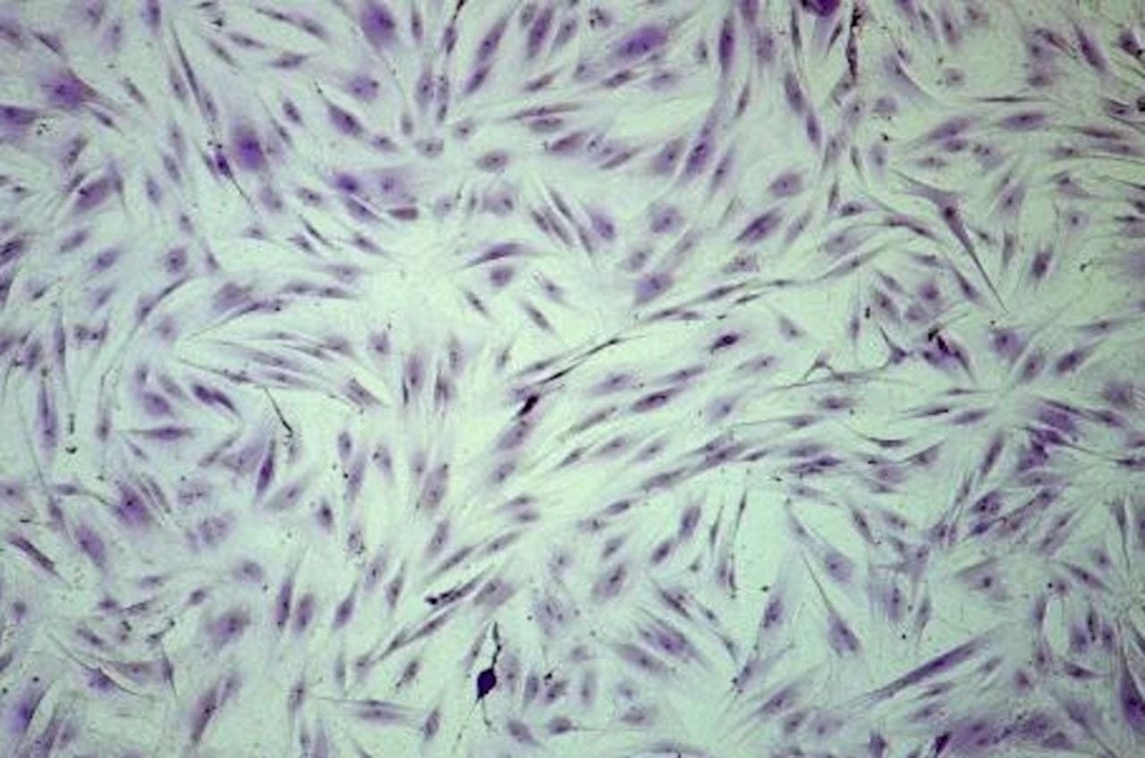 Fibroblasts 