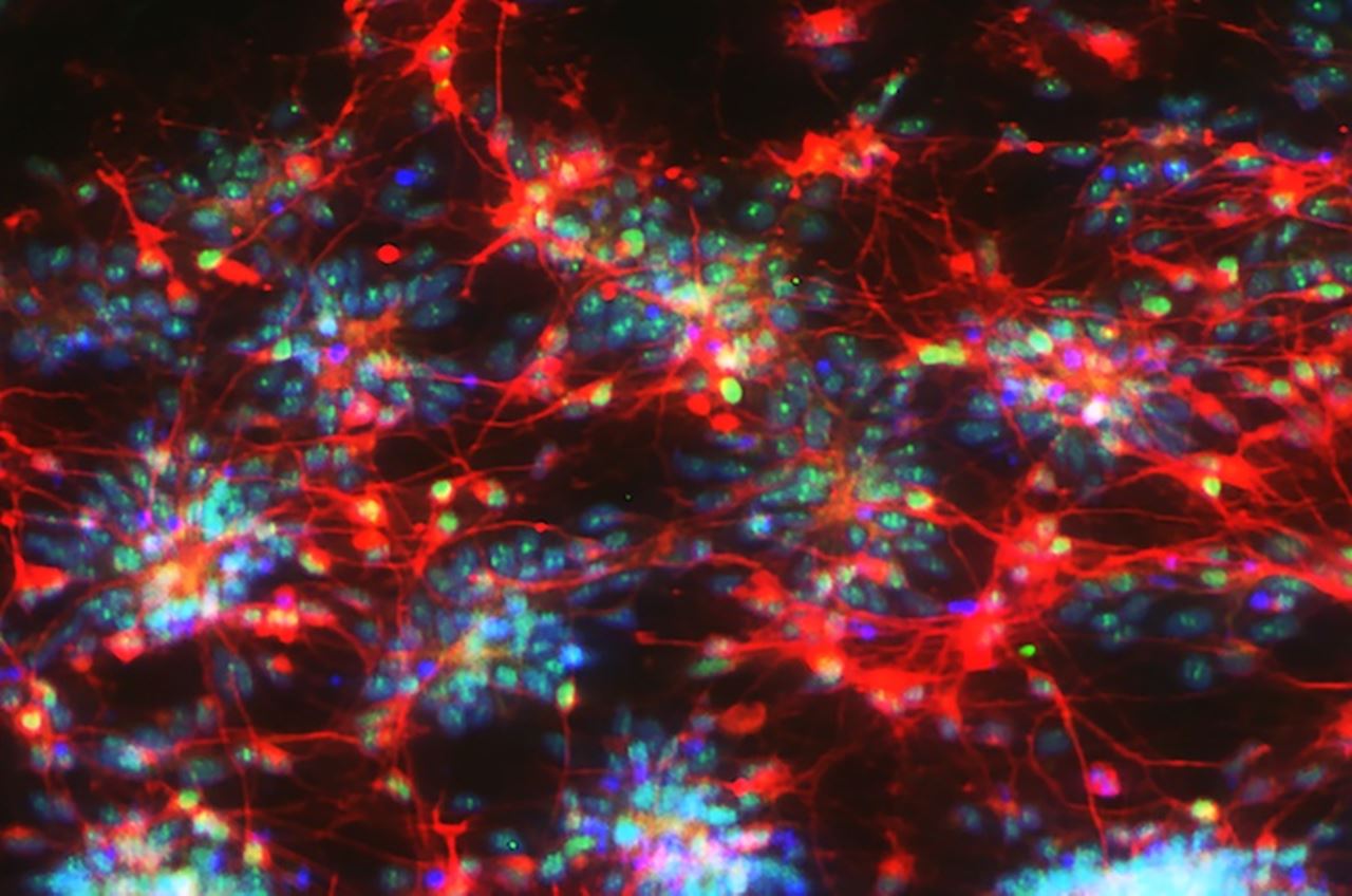 Validation of neuron growth 