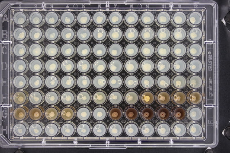 Colony morphologies of 96 Burkholderia cenocepacia isolates from cystic fibrosis patients. 