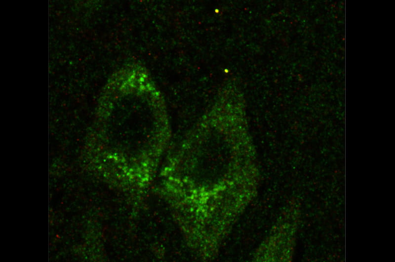 A dyed green image of a fibers in a human hippocampus