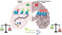 Animation of brain comparing Tip60HAT activation in a healthy brain and Tip60HAT turned off in an Alzheimer's disease brain