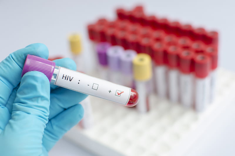 Technician holding a blood sample for HIV testing.