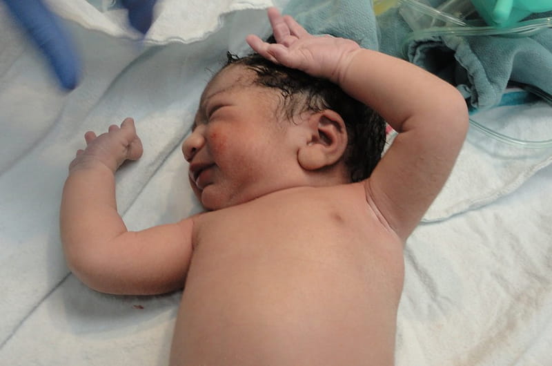 A newborn baby in the NICU