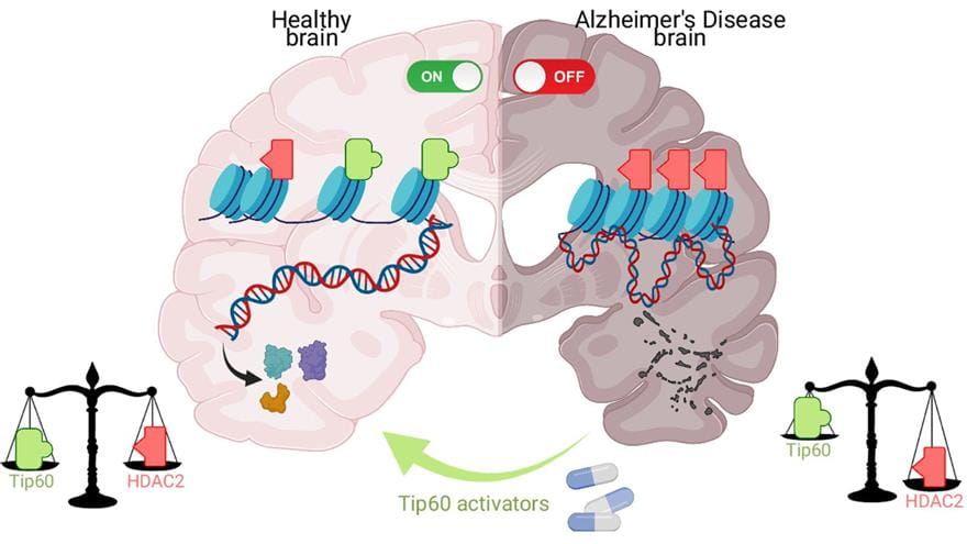 Animation of brain comparing Tip60HAT activation in a healthy brain and Tip60HAT turned off in an Alzheimer's disease brain