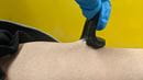 flexible hydrogel biosensor 