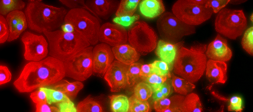 Dr. Spiller Macrophages