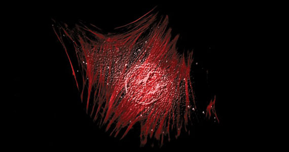 Fluorescence microscopy image shows the actin cytoskeleton (red) and the nucleus (grey) of a human cervical cancer cell by Elias Spiliotis, PhD