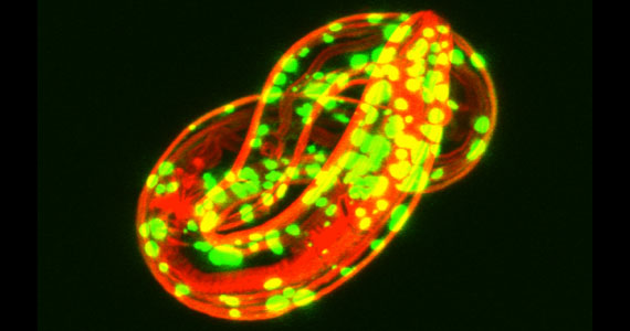C. elegans model of aggregation-prone SOD1 mutant protein. Green - SOD1-YFG fusion protein, 127x mutant; red - muscle actin. By Tali Gidalevitz