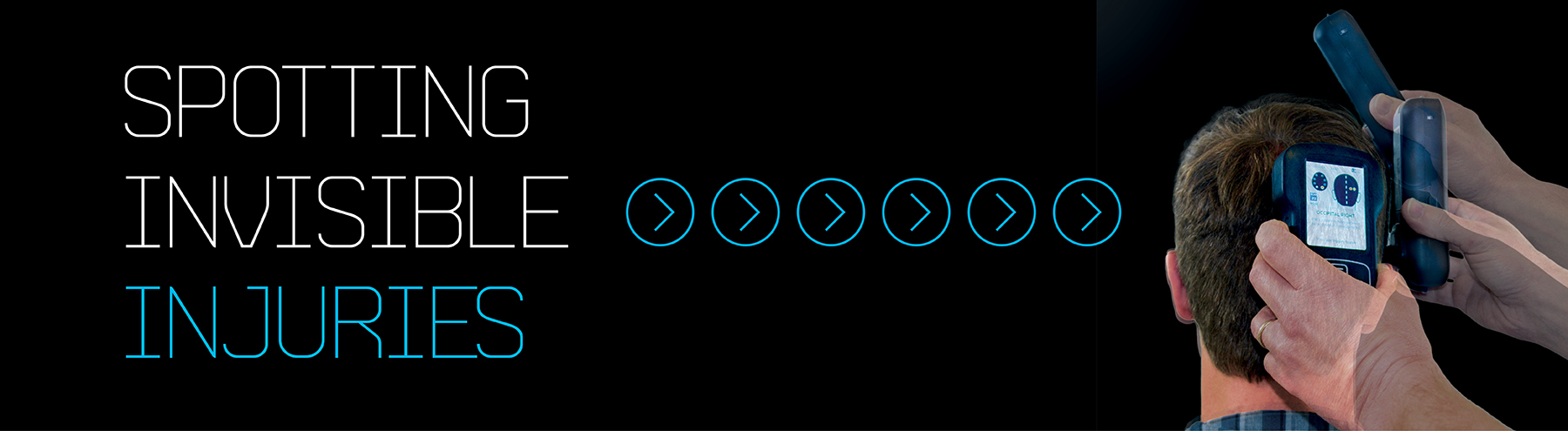 Handheld fNIRS Brain Bleed Diagnostic Device