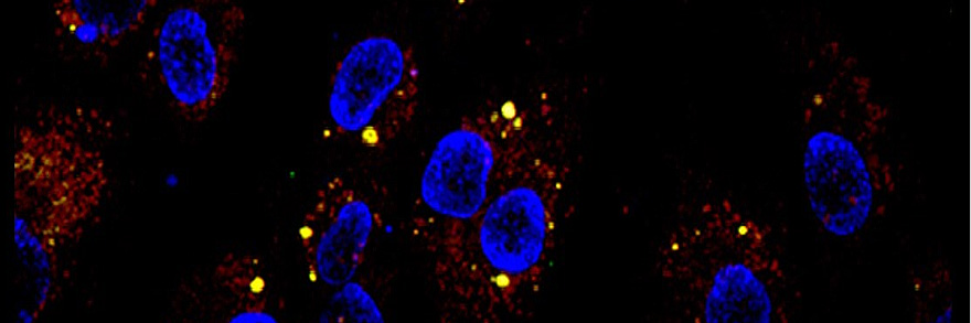 The Ajit Lab: Exosome uptake by HUVEC cells.