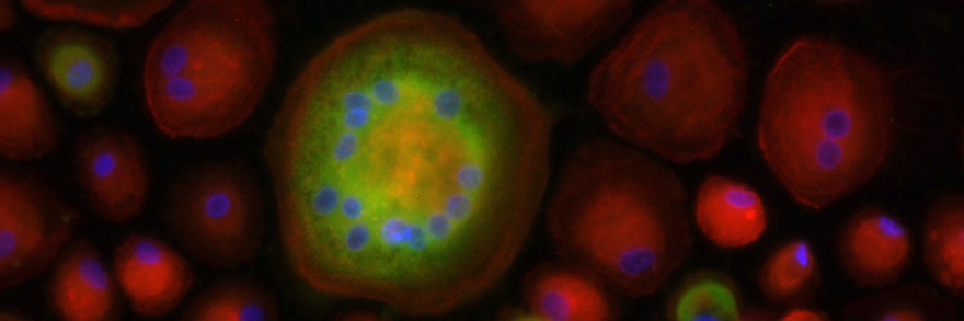 Fluorescent image primary human macrophages