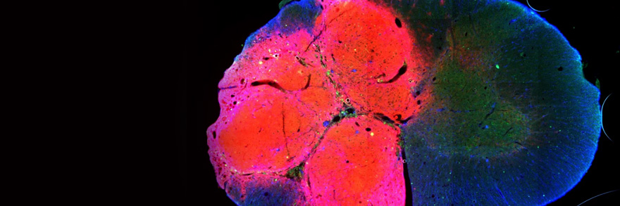 Drexel Lane Lab Research: Transplanted neural progenitor cells to repair the injured spinal cord.