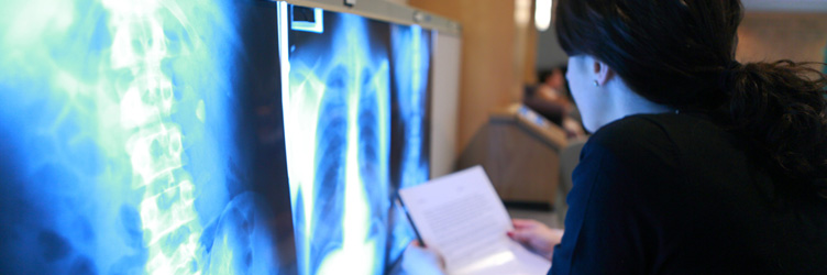 Medical student reviewing x-ray images at a hospital.