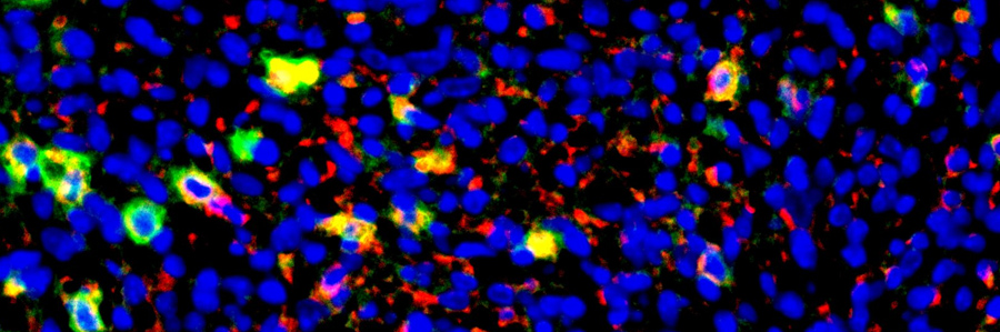 Multiplex staining of immune cells and chemokines in mouse tumor samples. Source: Romano Lab