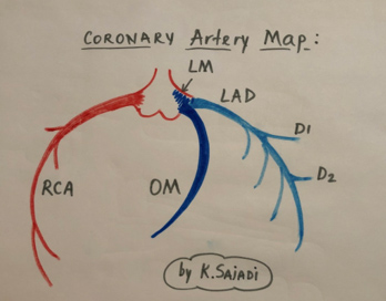 Coronary Artery Map